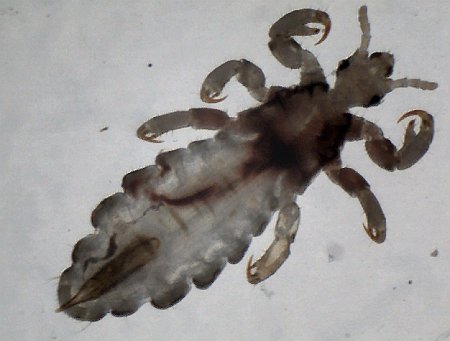 Human head louse (sucking type)